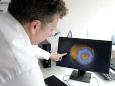 Ophtalmologie : un centre mondial d’excellence, le CRIO, s’installe à Saint-Étienne La Région Auvergne-Rhône-Alpes investit 5,7 millions d'euros pour créer un centre d'excellence mondial en ophtalmologie à Saint-Étienne