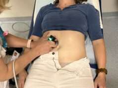 Endométriose, Saint Joseph Saint Luc renforce ses soins Endométriose, la técarthérapie entre à l’hôpital pour soulager sans surcoût